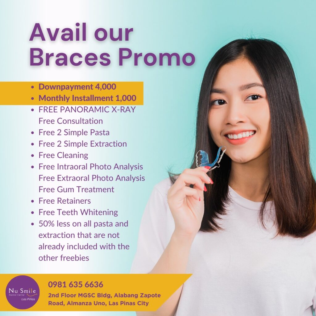 Nu Smile Braces Promo 2