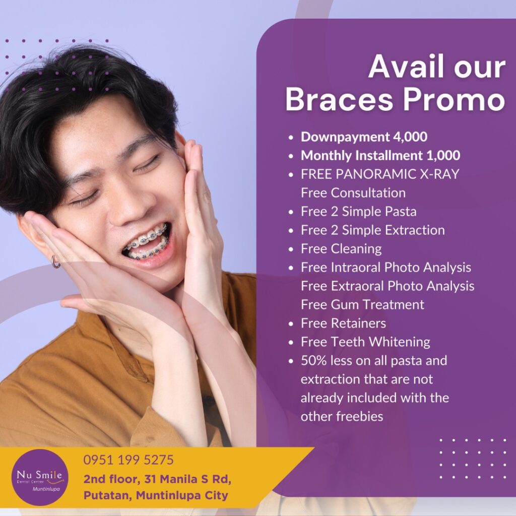 Nu Smile Braces Promo